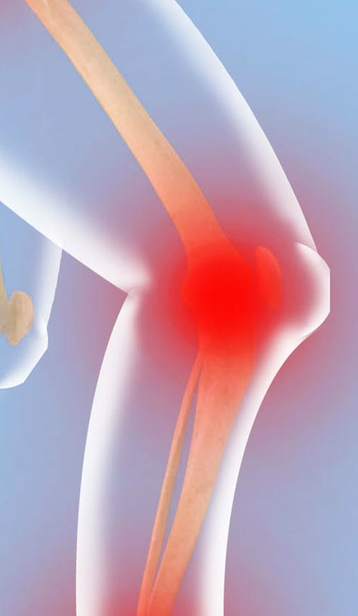 οστεοπόρωση-ορθοπαιδικός-osteoporosh-orthopaidikos